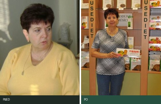 Jaroslava Gabašová — proměna před a po
